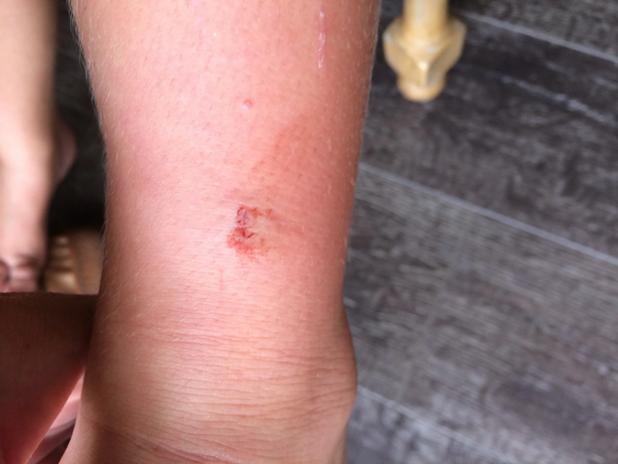 sleepovers, swimming, & snakebites