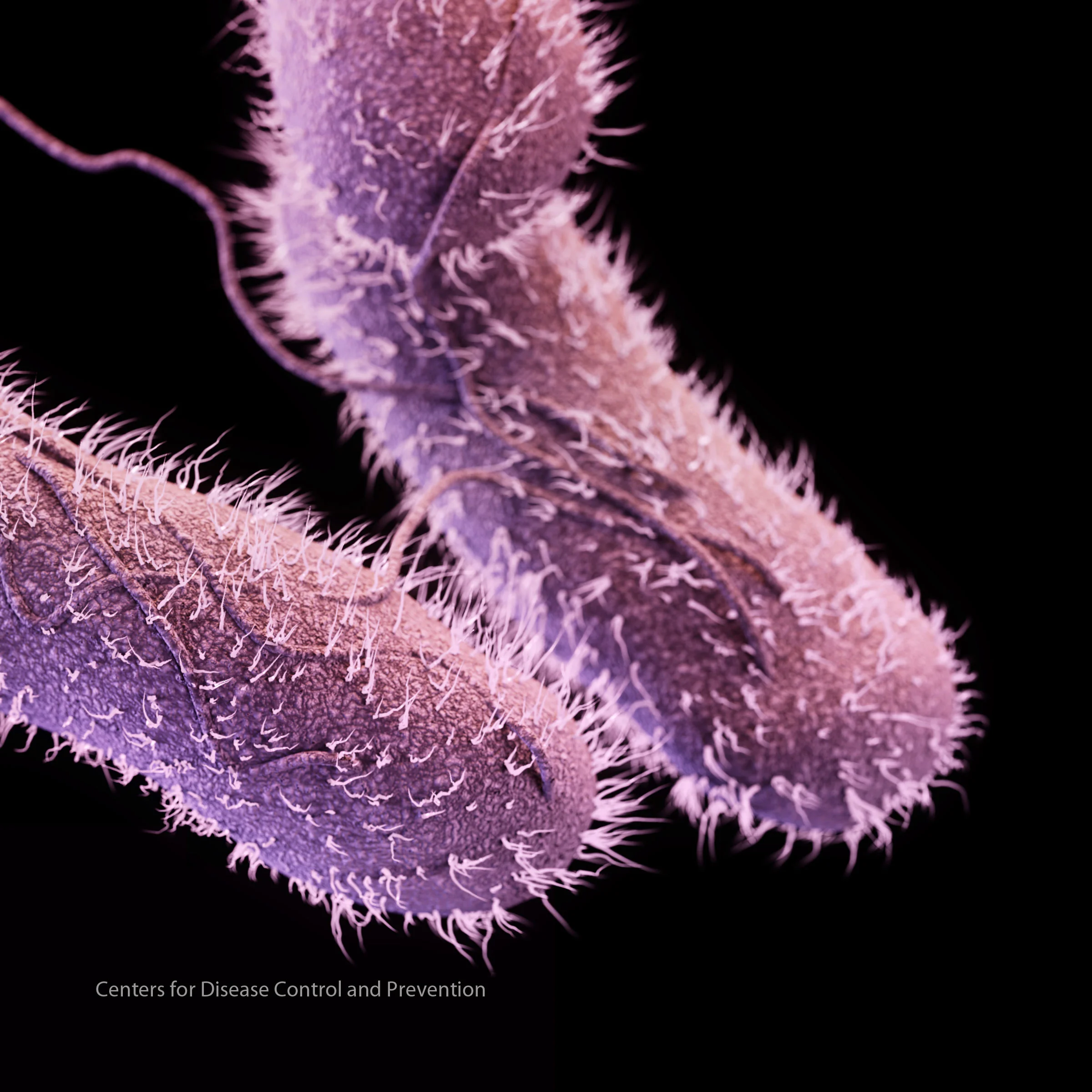 cdc-09-13-img16-salmonella.jpg