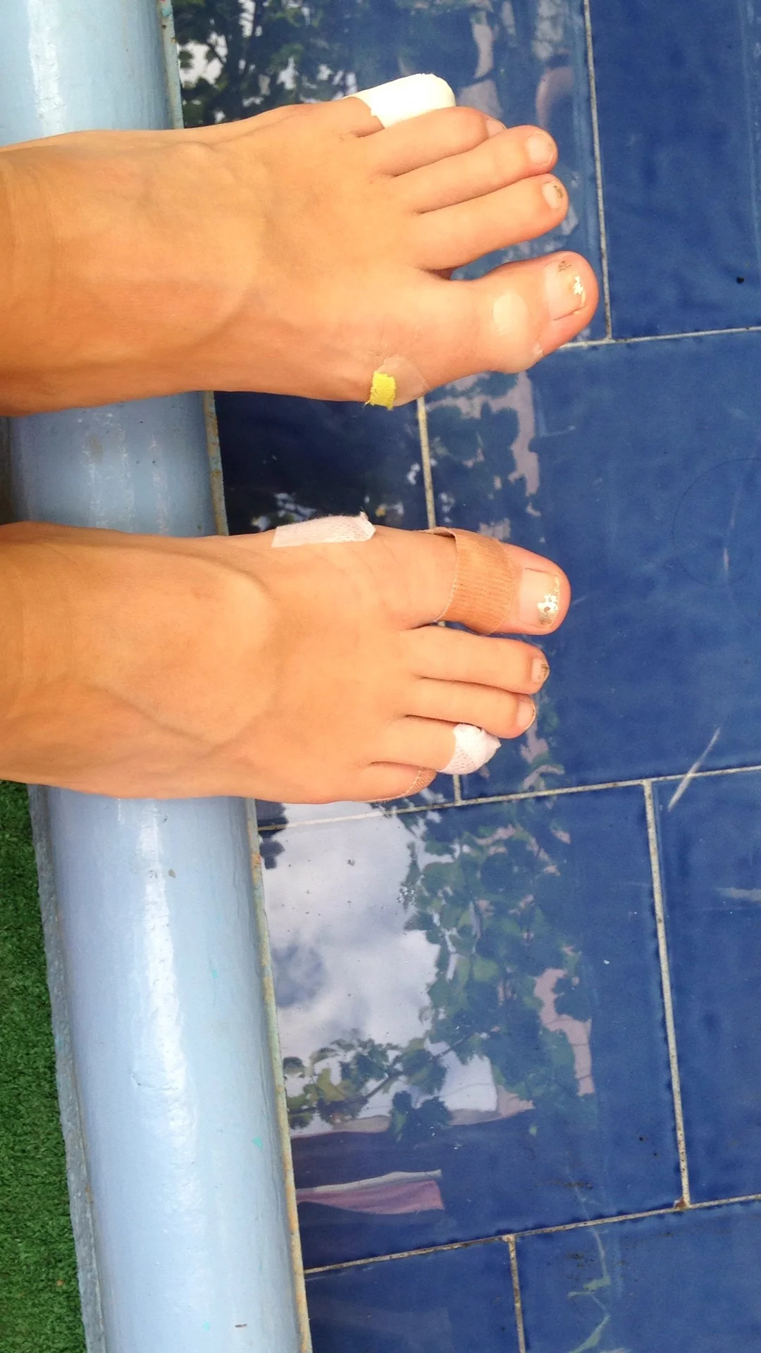 Poor feet