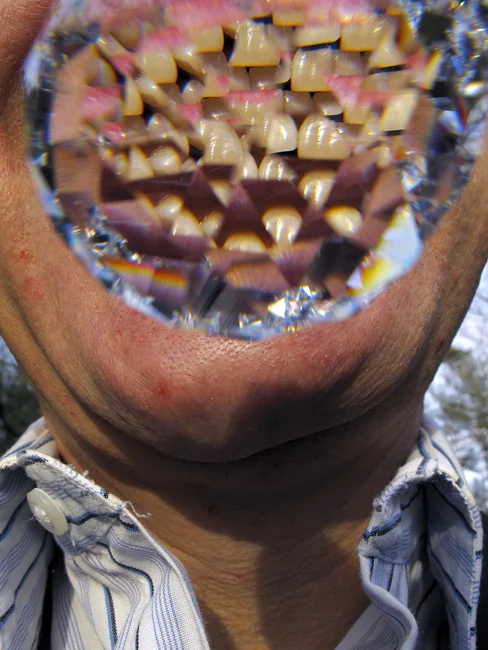 Through a lens, teeth 2013, 43" x 32", Pigment print