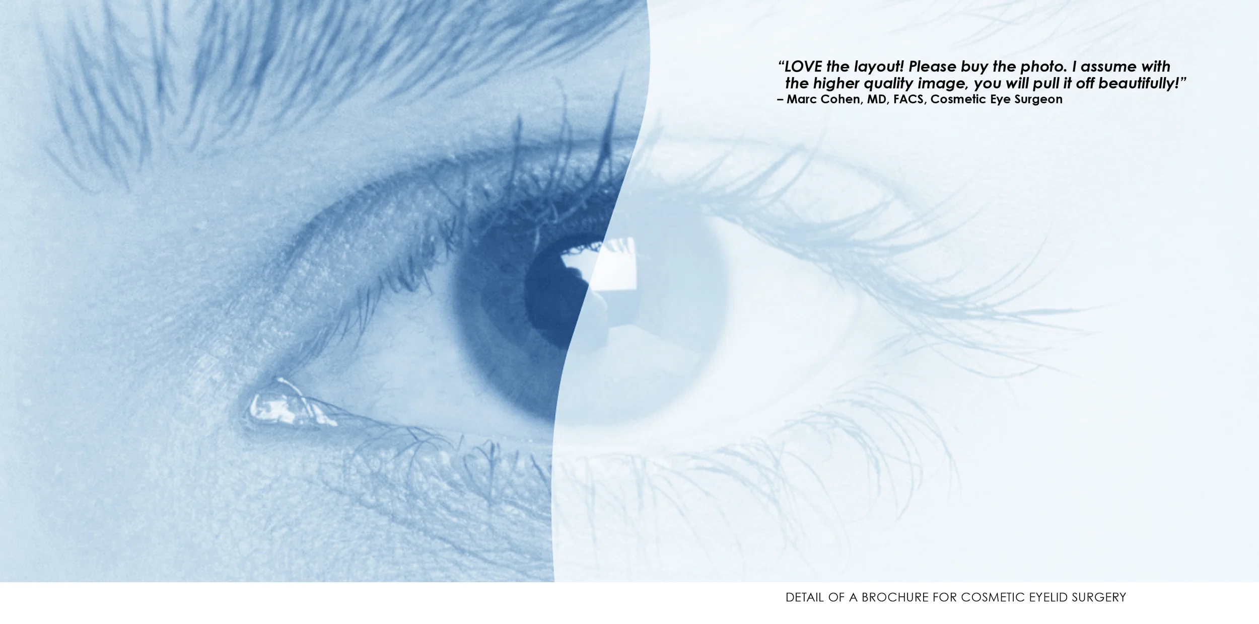EYELID-SURGERY.jpg