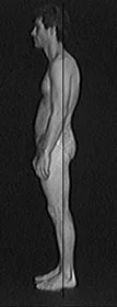 Rolfing man side 2.jpg