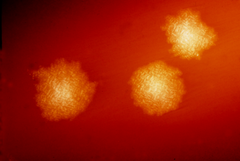 C.difficile colonies - something you don't want too much of in your gut. Thanks to Wikipedia.