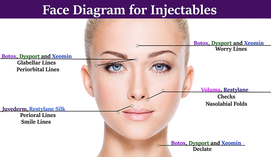 Botox Face Chart