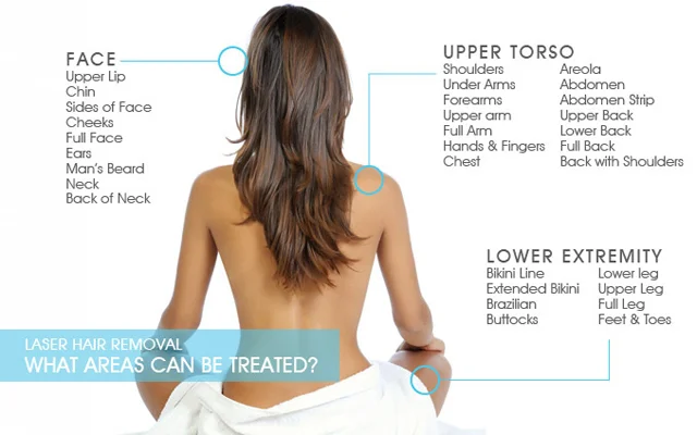 LaserBodyAreas.jpg