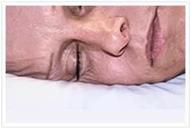 Compression, shear and tension forces damage our facial skin whilst we sleep
