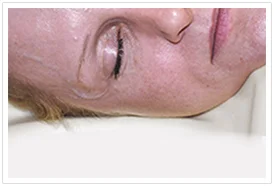 Speciality pillows may help reduce wrinkles