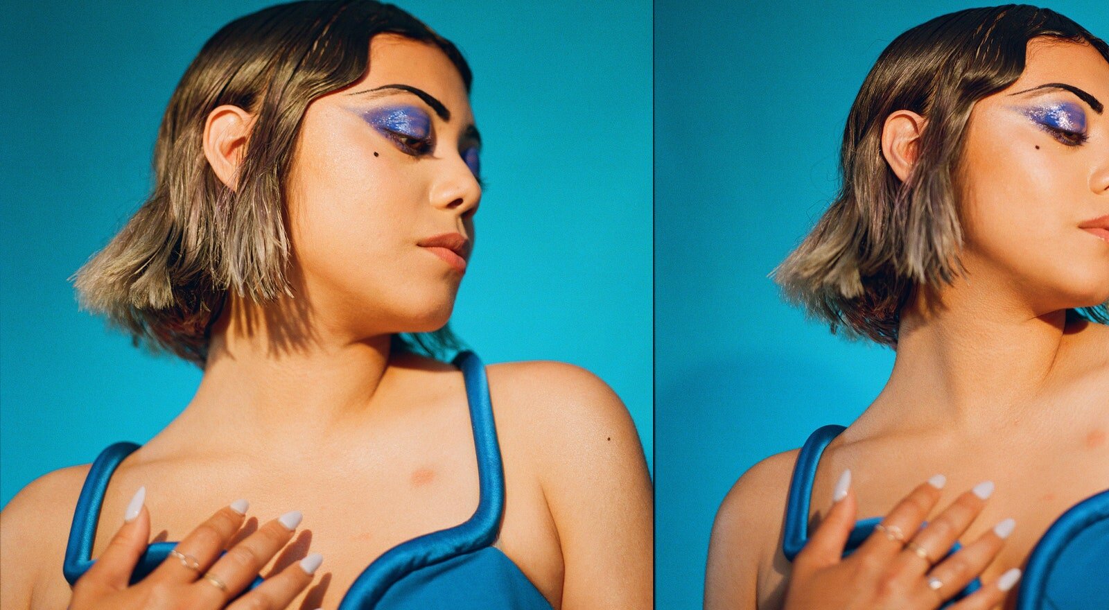Allure X Psoriasis