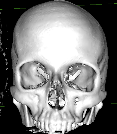 3D Reconstruction