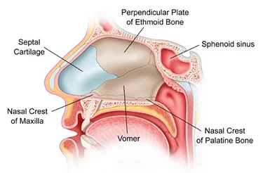Septoplasty and turbinate reductions