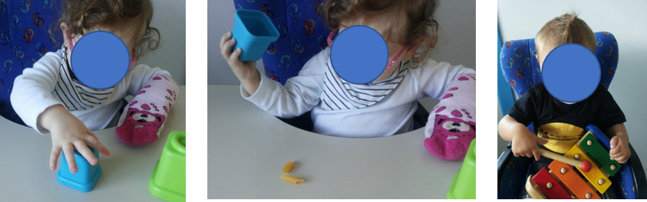 Approfondimenti sulla Constraint Induced Movement Therapy (CIMT)