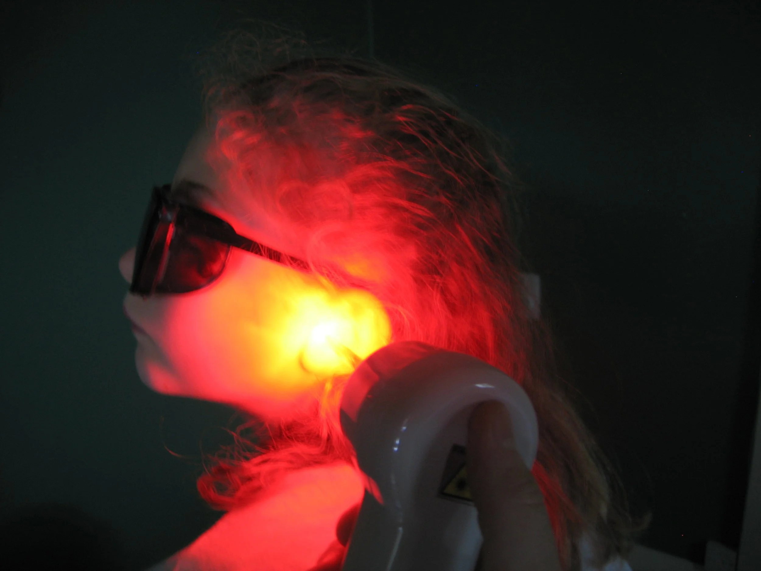 Laser Treatment - Child, Ear Infection