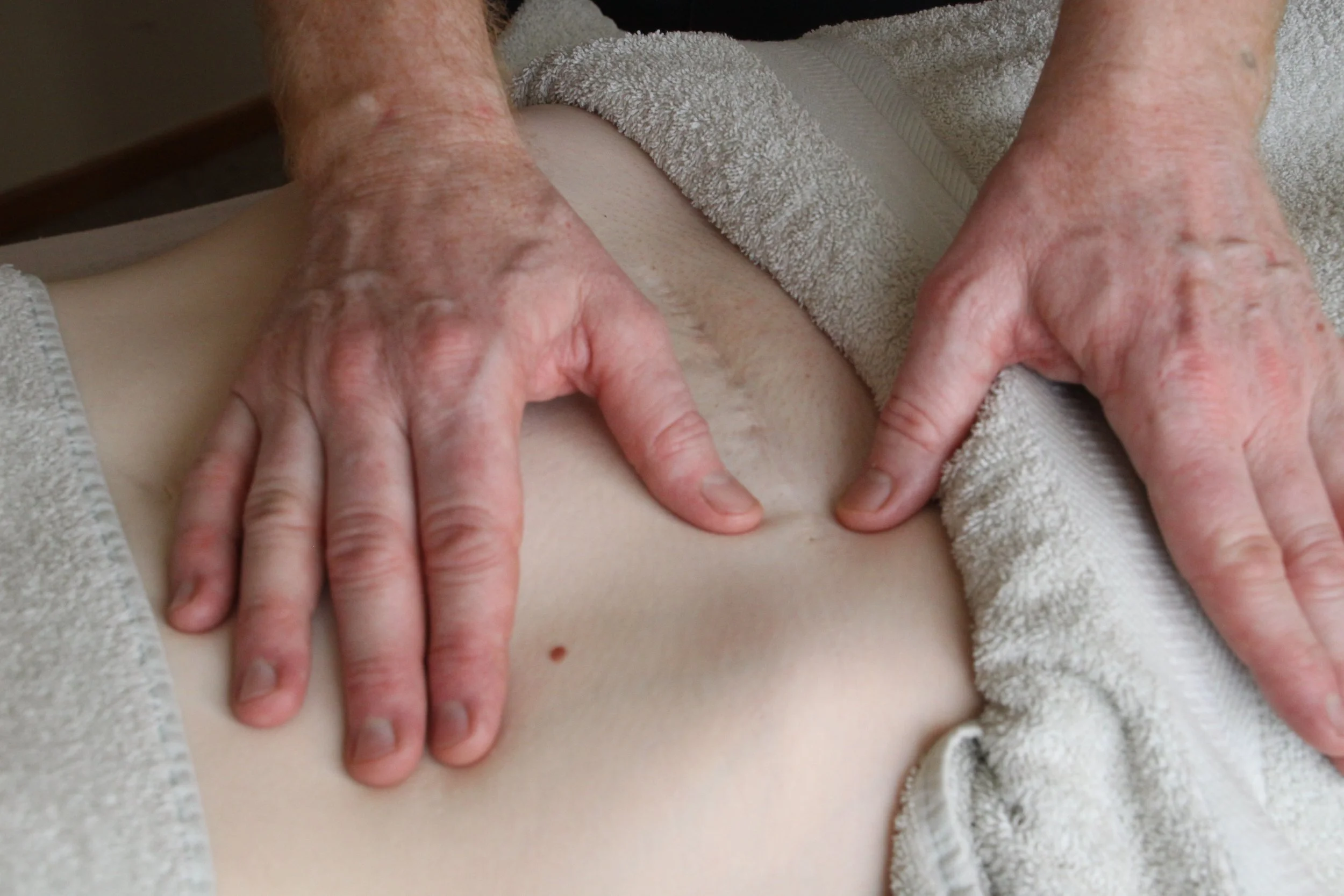 C-Section Treatment