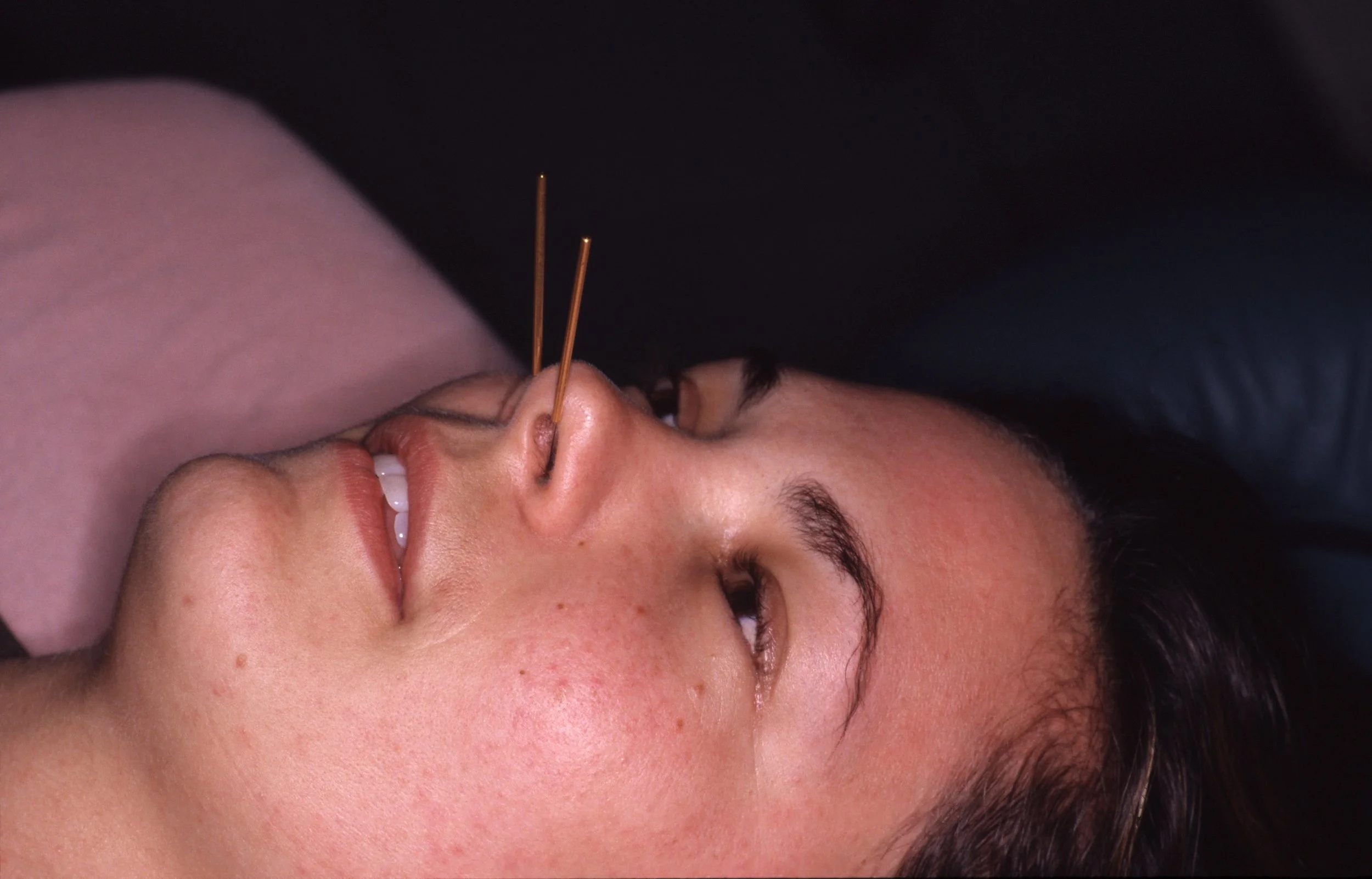 Endonasal Reflexology