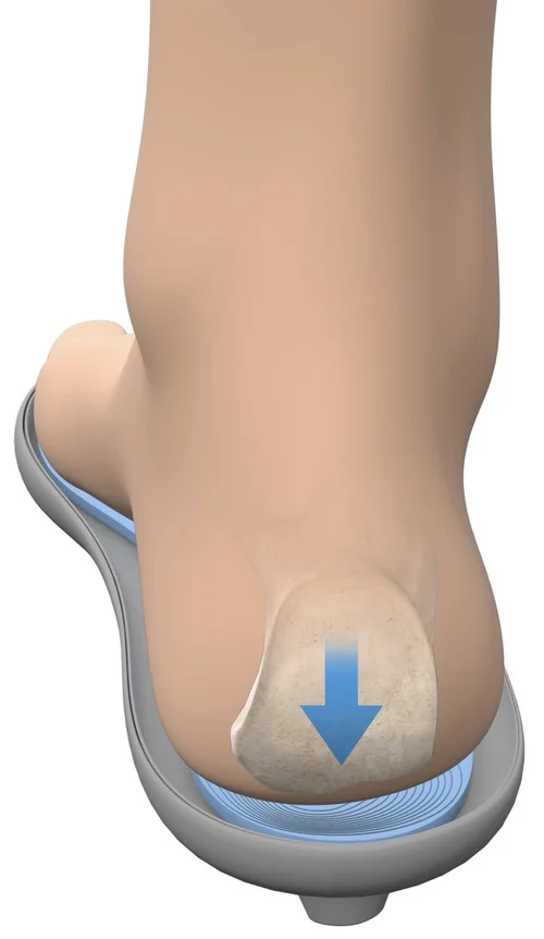 Cradle Insole Improve Footwear Comfort with Insolia® Technologies