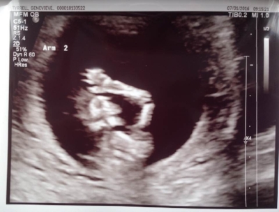 showing off horror flick moves in utero