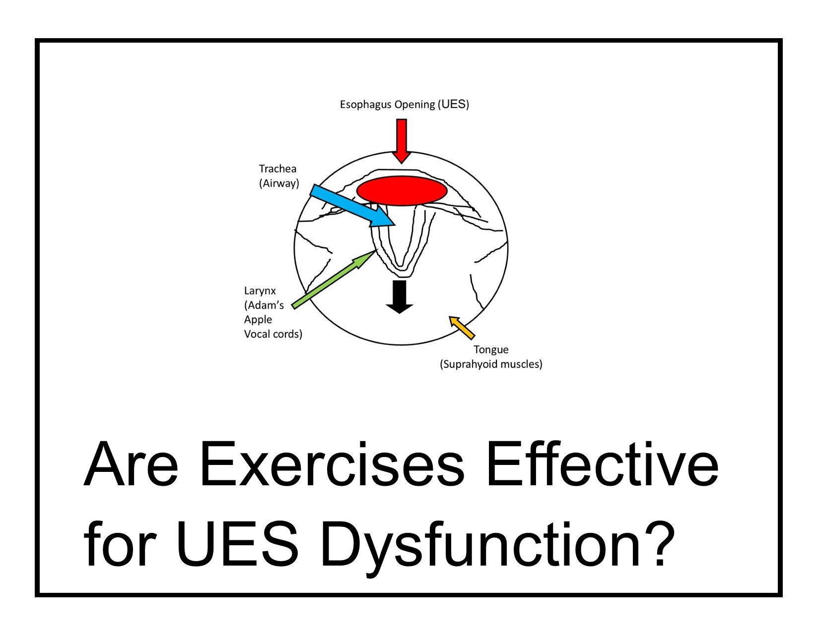 Are Exercises Effective for UES Dysfunction?