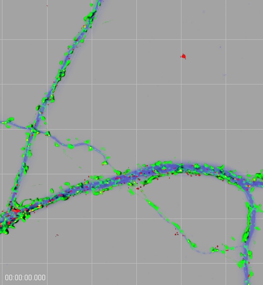 Close-up view of a neuron, with classic markers showing MAP2 (blue)-positive dendrites, actin-rich protrusions (green) and RNA-containing granules (red). Copyright Jason Dictenberg