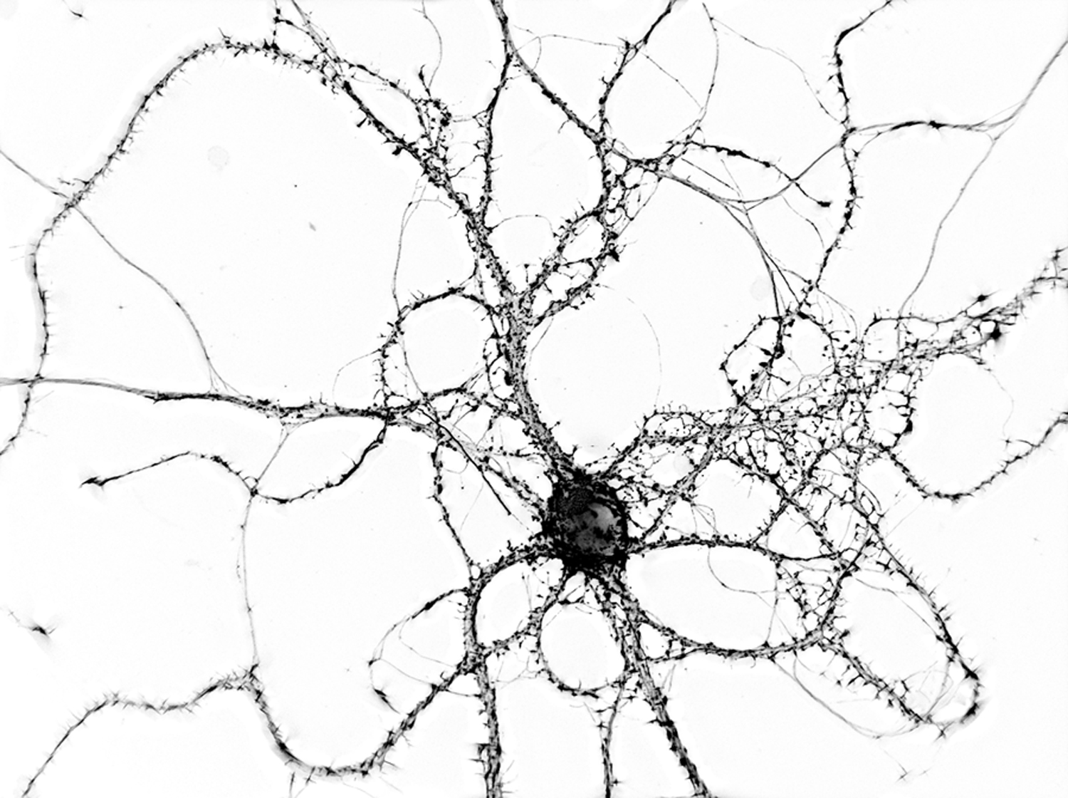 Mouse hippocampal neuron grown 21 days in vitro, stained for synapses with the actin-binding drug phalloidin, and imaged using 3D wide-field digital microscopy. The image was resolved in using super-resolution deconvolution algorithms to view fine details such as the synaptic cytoskeleton, and rendered in 3D. Copyright Jason Dictenberg, PhD.