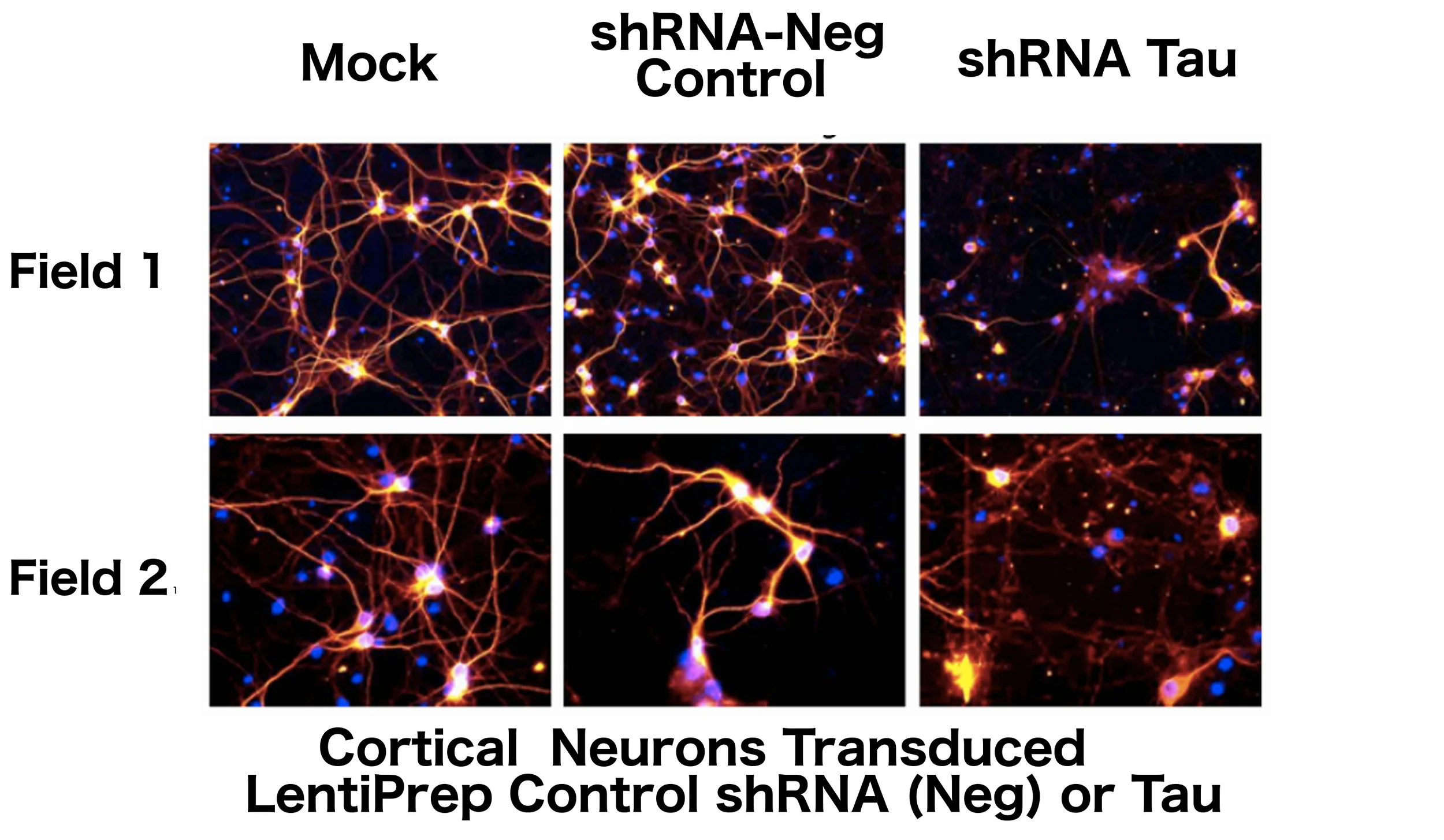 LentiPrep targeted shRNA against Tau can efficiently knockdown Tau protein (red) after 72 hours. DAPI stained nuclei (blue) identify cell numbers after 6 DIV.