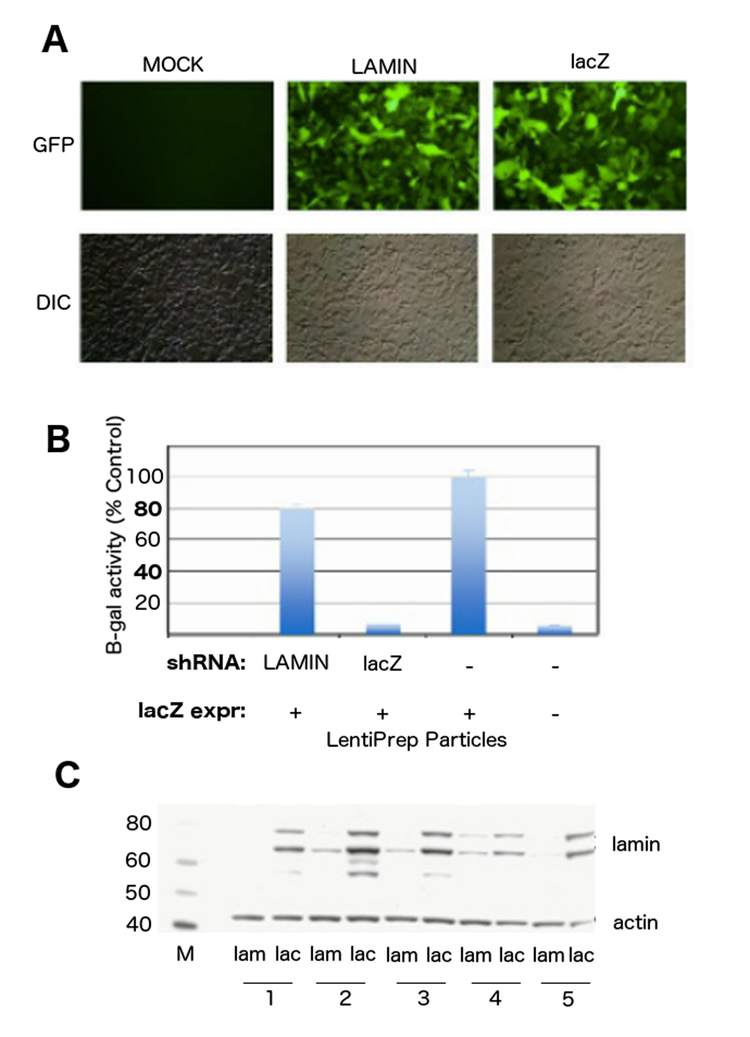 (A) HEK293 cells (DIC) were transduced with LentiPrep particles expressing lacZ gene, and co-transduced with either LentiPrep particles containing shRNA to lacZ (lacZ), negative control lamin (lamin) gene, or mock transduced (Mock), with all vectors containing a co-expressed GFP marker (GFP) on the plasmid for transduction confirmation. (B) B-galactosidase activity assay to determine extent of shRNA knockdown of lacZ expression in cells from panel (A). B-galactosidase activity was normalized to control cells containing lacZ transduction alone, while shRNA co-transduced cells showed decreased lacZ expression depending on the gene targeted. This is in contrast to control cells with no lacZ expression which show no significant level of activity (n=3-5 experiments per treatment). (C) Western blot for lamin (shRNA knockdown) or actin (control, empty shRNA vector) proteins after stable transduction and expression of shRNA LentiPrep contructs. Each cell population (#1-5, bottom) were tested for lamin (lam) and lacZ (lac) expression, and all showed significant knockdown of lamin proteins (antibody recognizes lamins A/C as two separate sized bands at 68-78kD). Marker (M) shown on left side with sized bands.