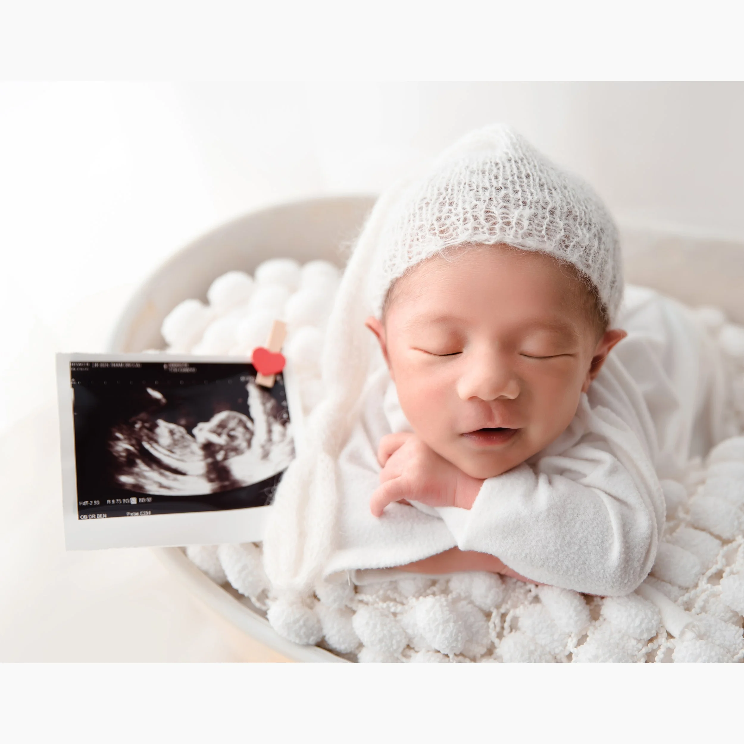 Sleeping newborn in a white bathrobe and knitted hat resting on folded arms beside a framed ultrasound picture