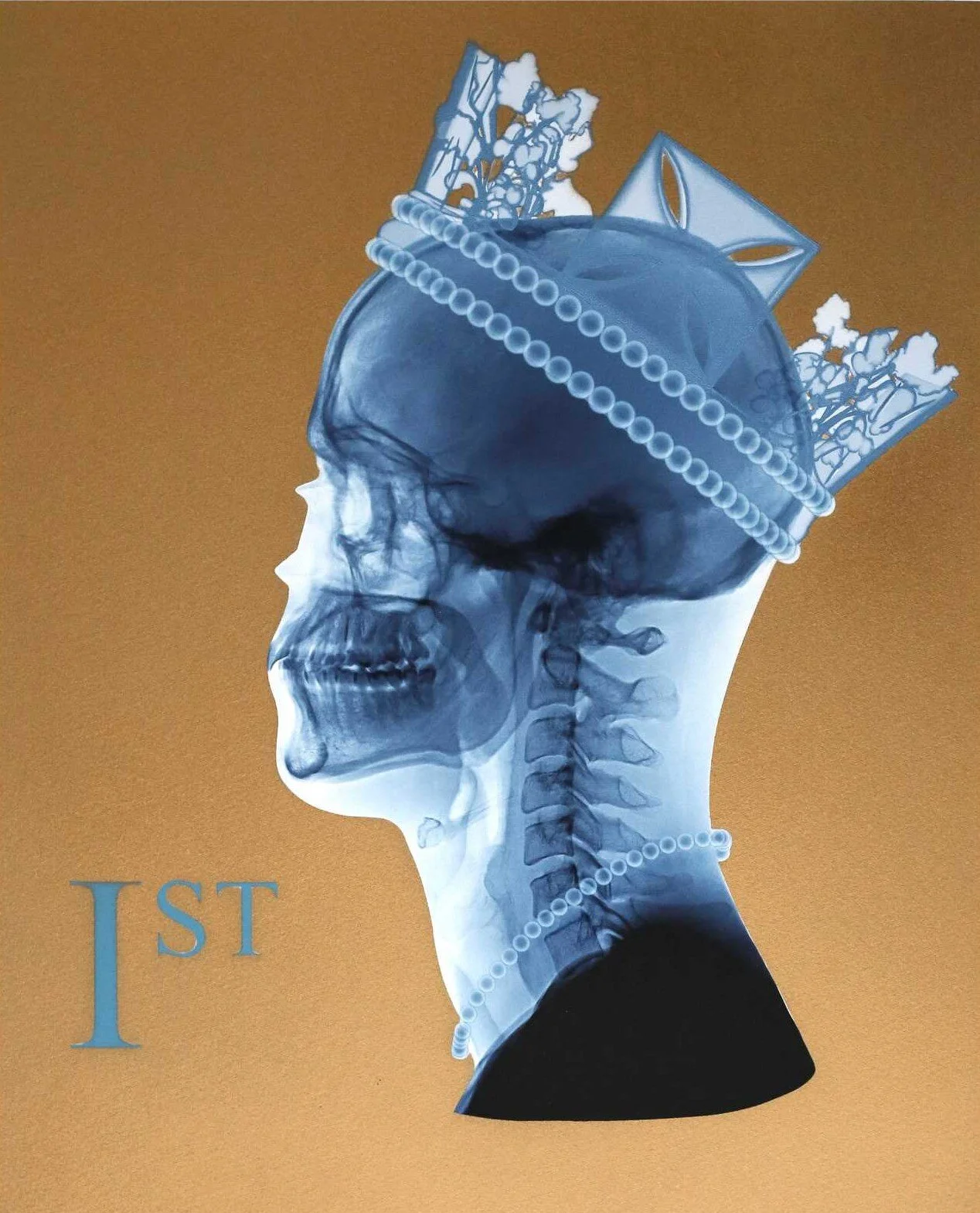 First Lady (Gold), by Ernesto Romano