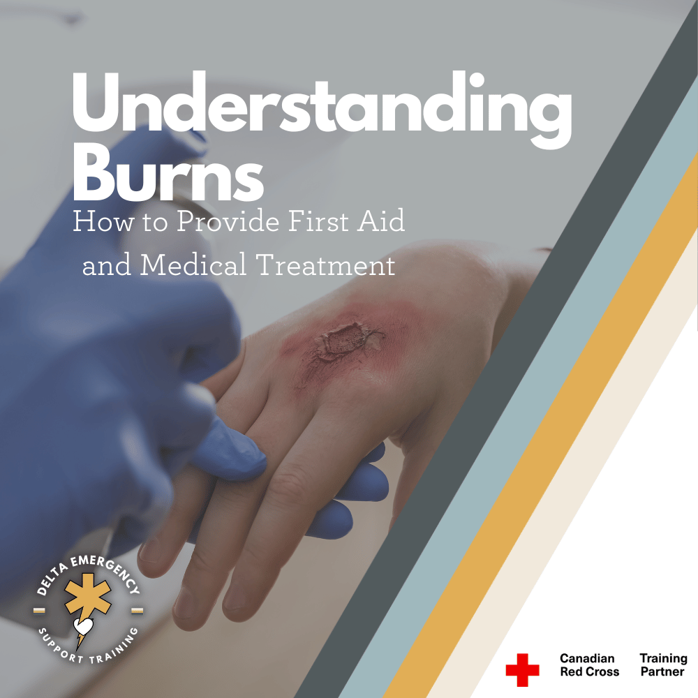 Burn Management: Understanding Burns and How to Provide First Aid