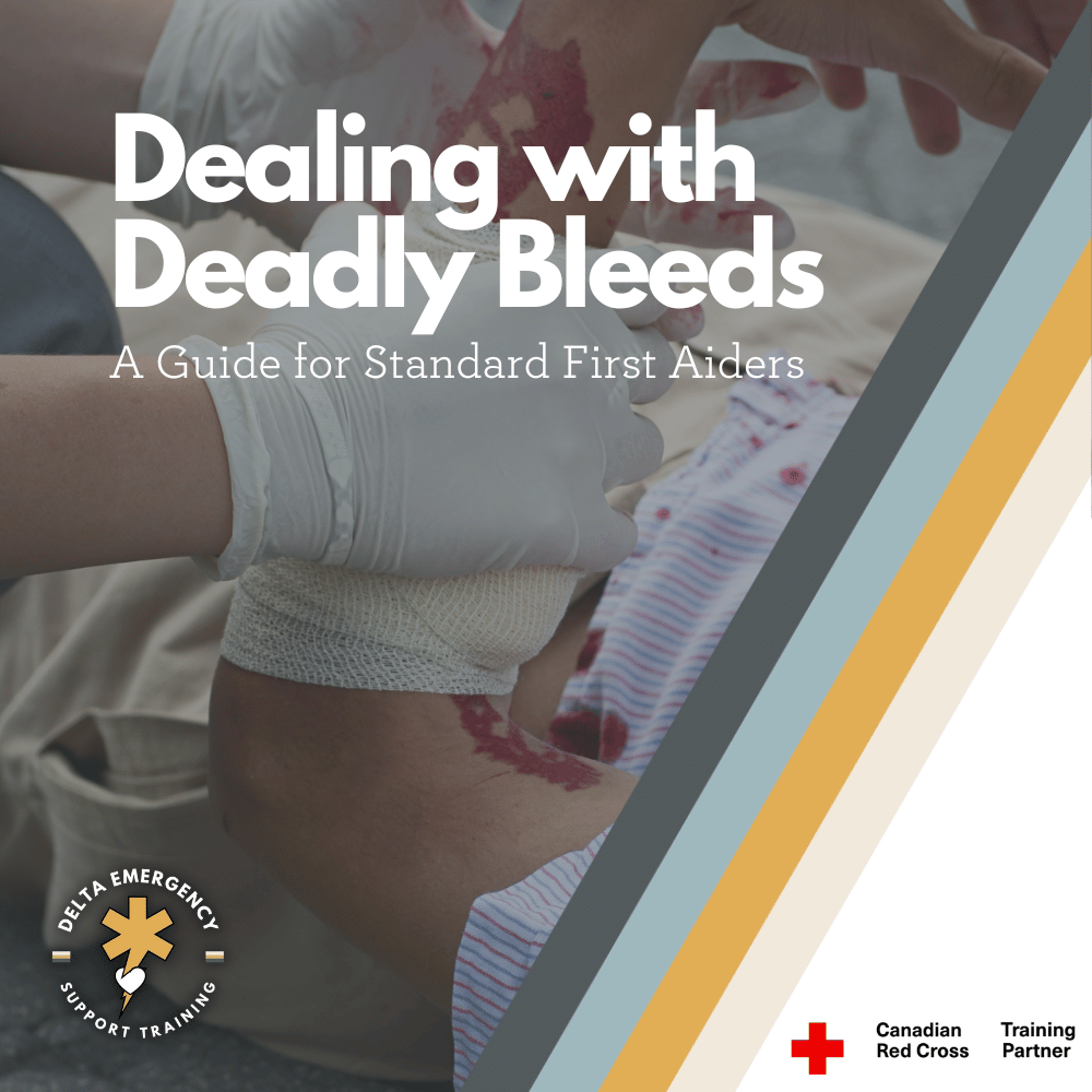 Dealing with Deadly Bleeds: A Guide for Standard First Aiders