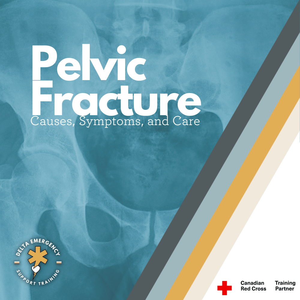 Navigating the Complexity of Broken Pelvis: Causes, Symptoms, and Care