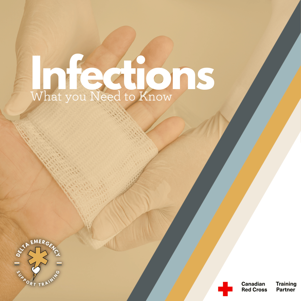 Infections: What you Need to Know