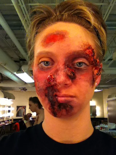 Wound
