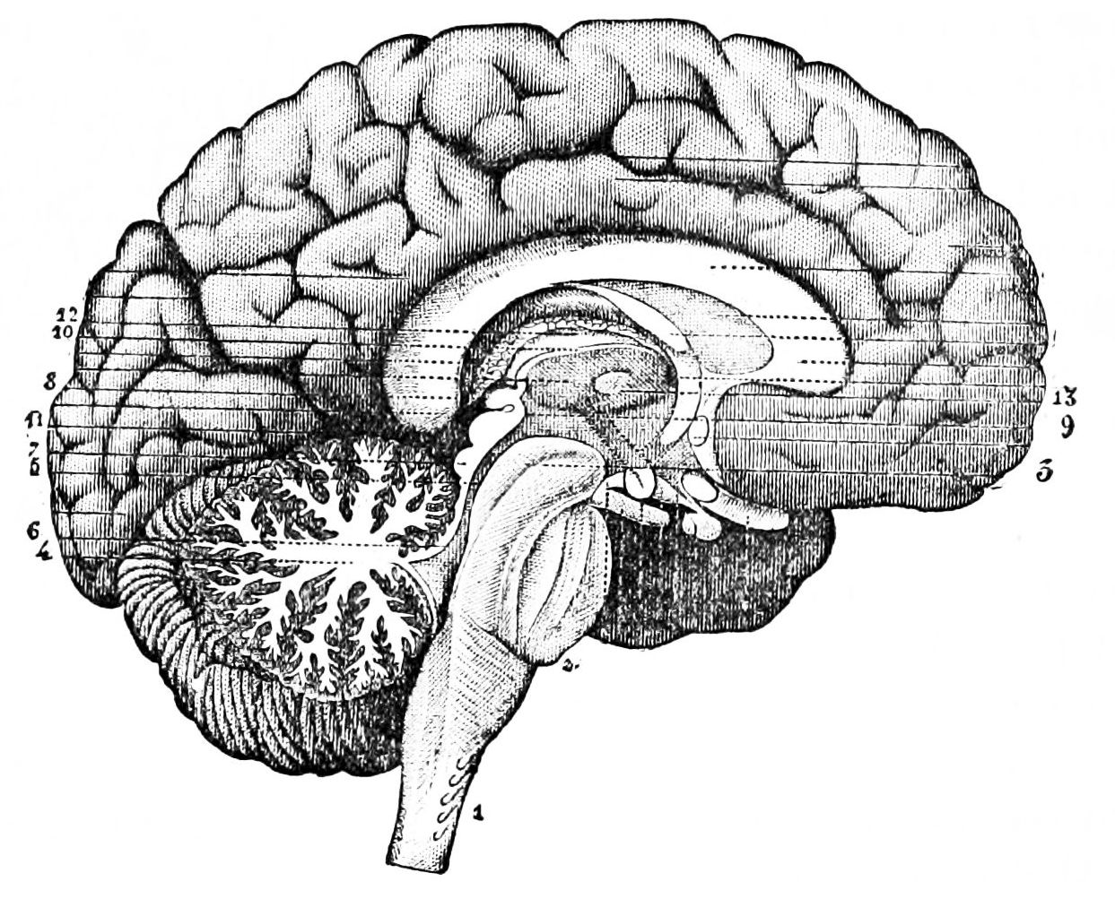 brain.jpg