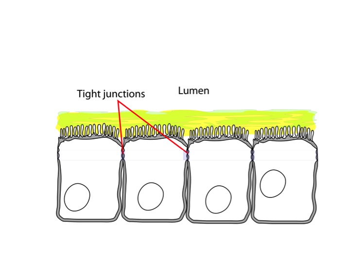Small intestinal cells: Without the tight junctions, leaky gut develops.