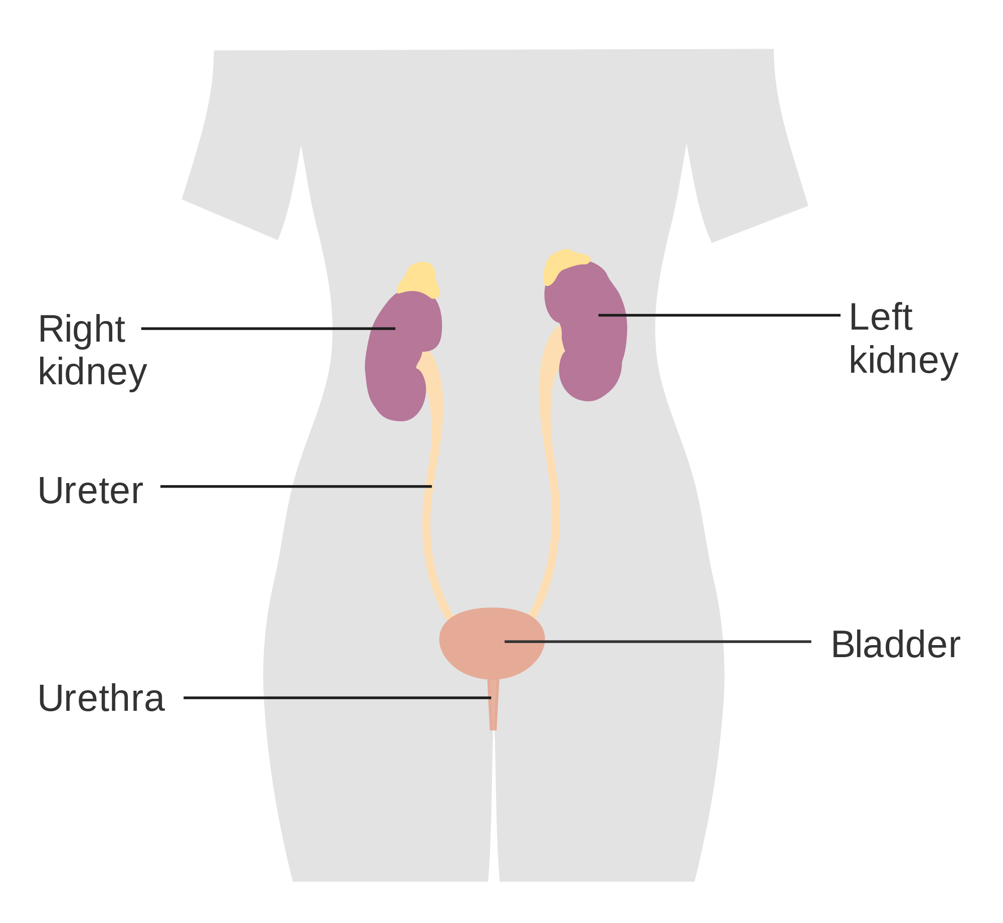 AGH! WORSE THAN CHILD BIRTH! KIDNEY STONES & HOW TO PREVENT THEM — Tracey Reed Holistic Nutrition