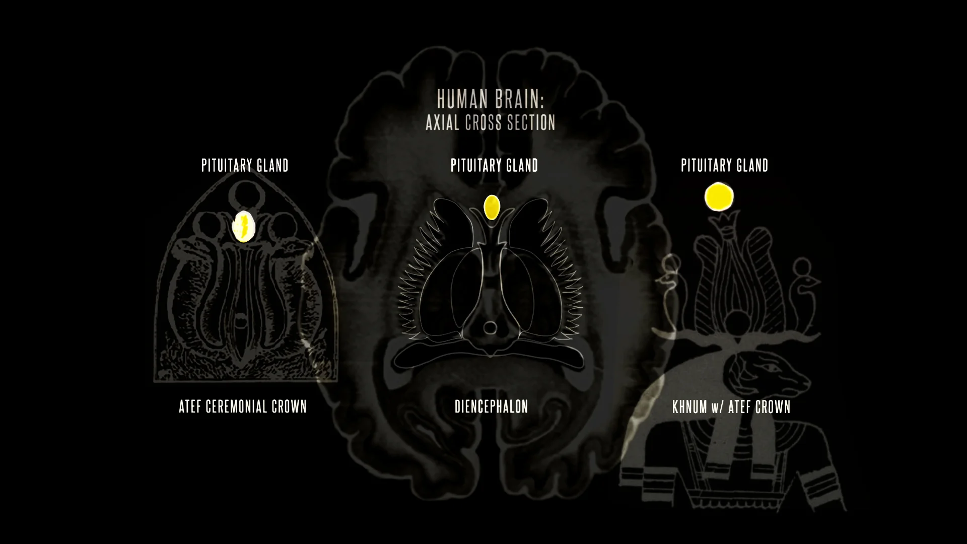 walnut atef pituitary x3 boardnew.jpg