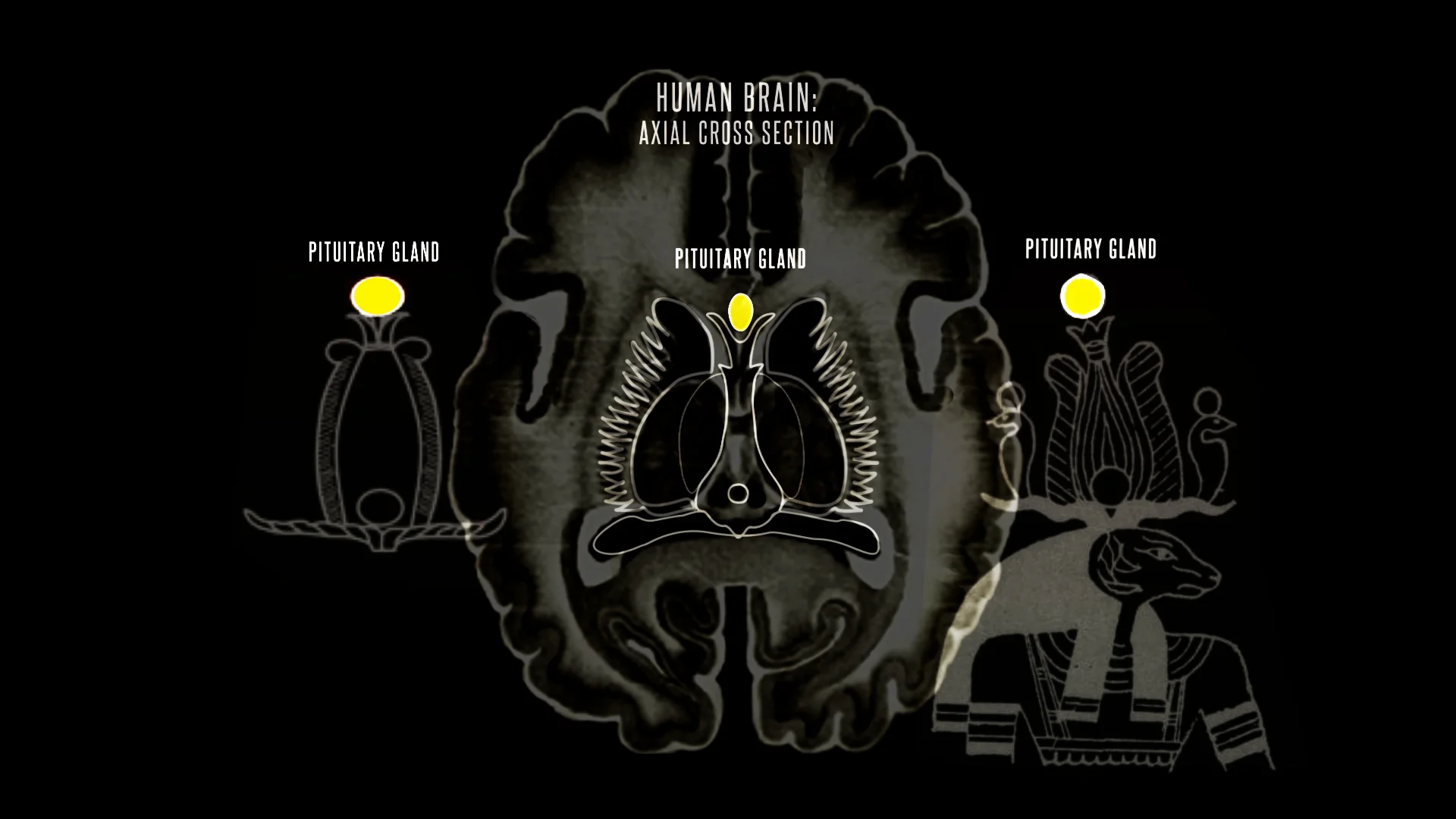 walnut pituitary hilite.jpg