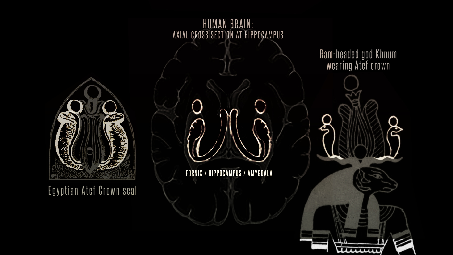 Brain Atef amygdala khnum triple comparison.jpg