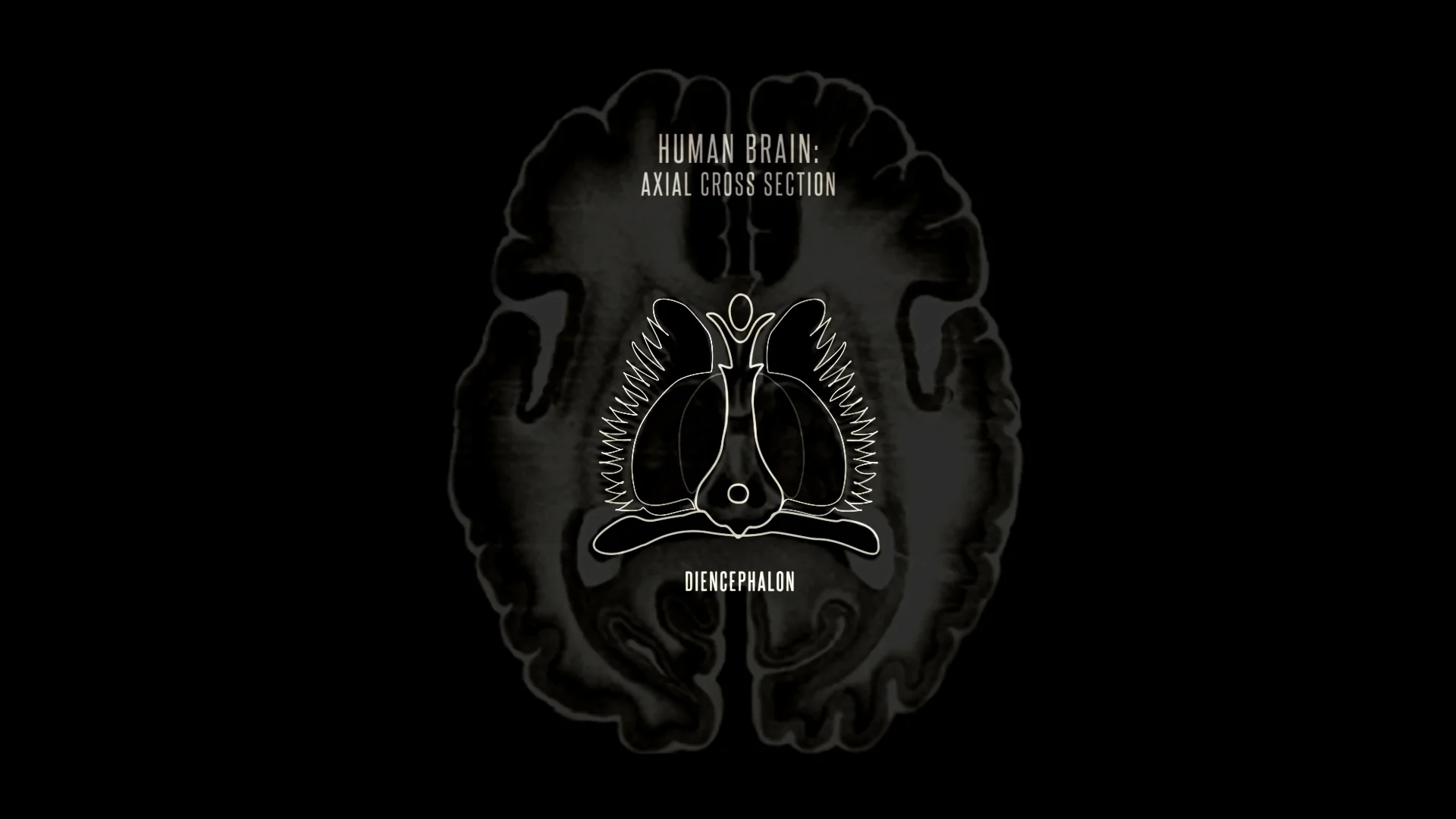 walnut brain only dienceph outline first.jpg