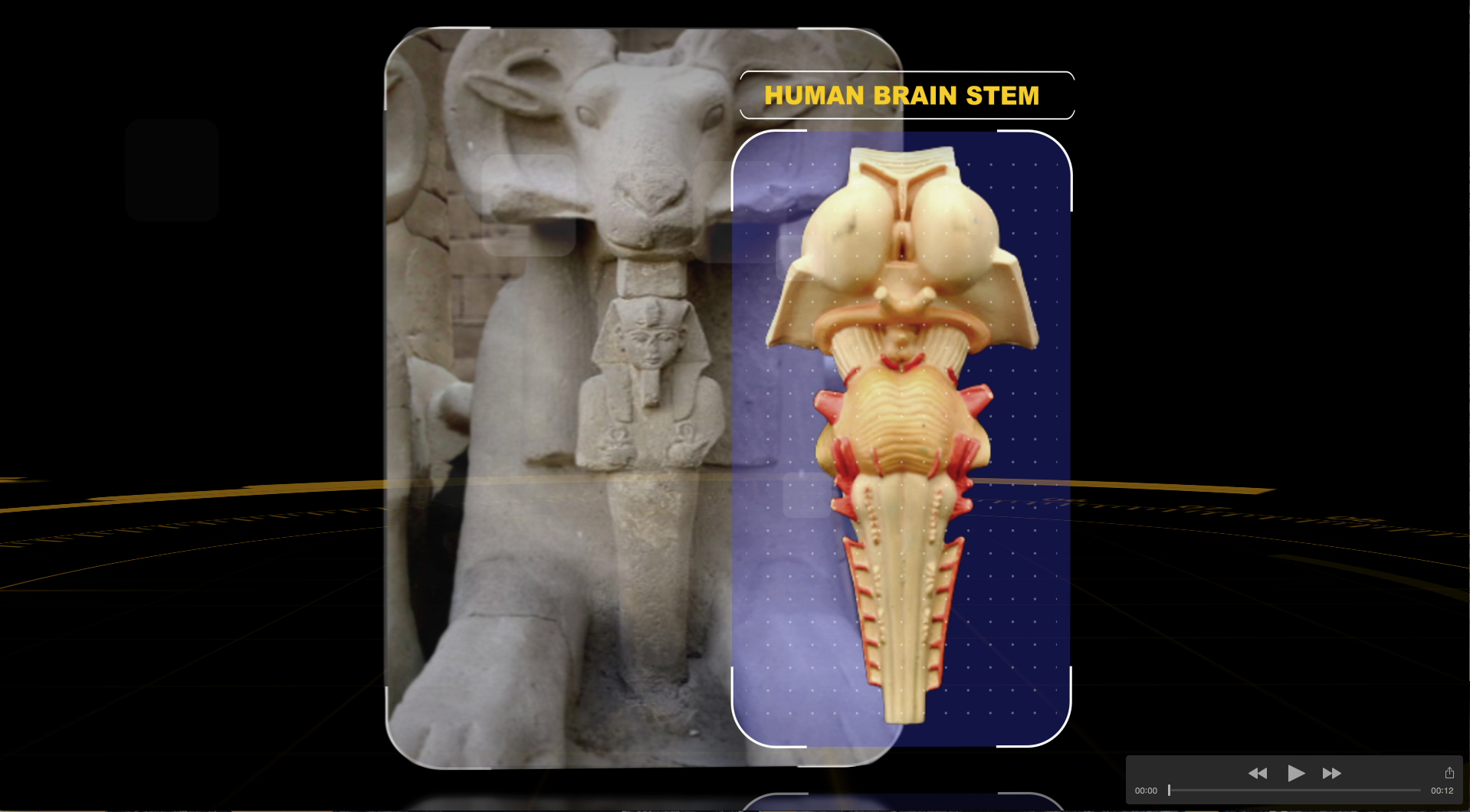 brain stem ram comparison.jpg