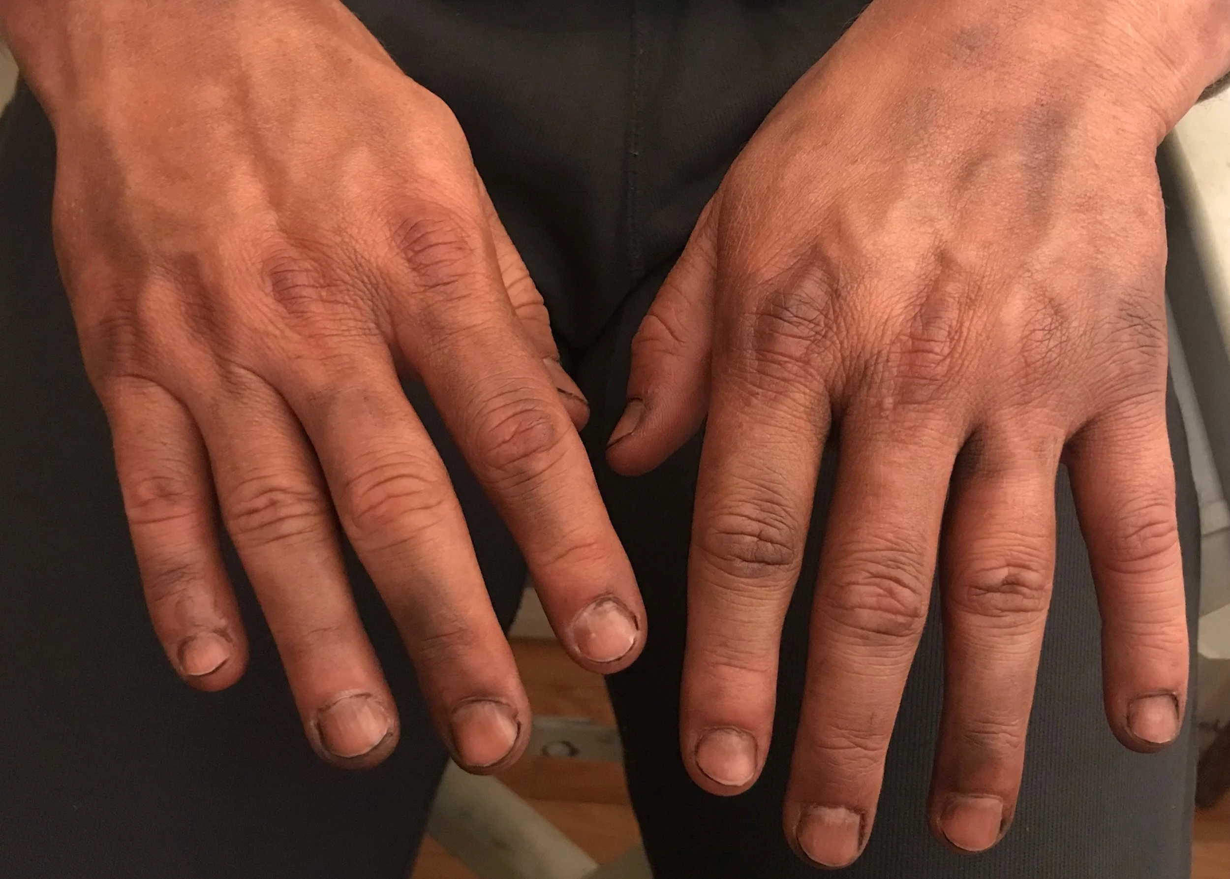 Dirtyhands.jpg