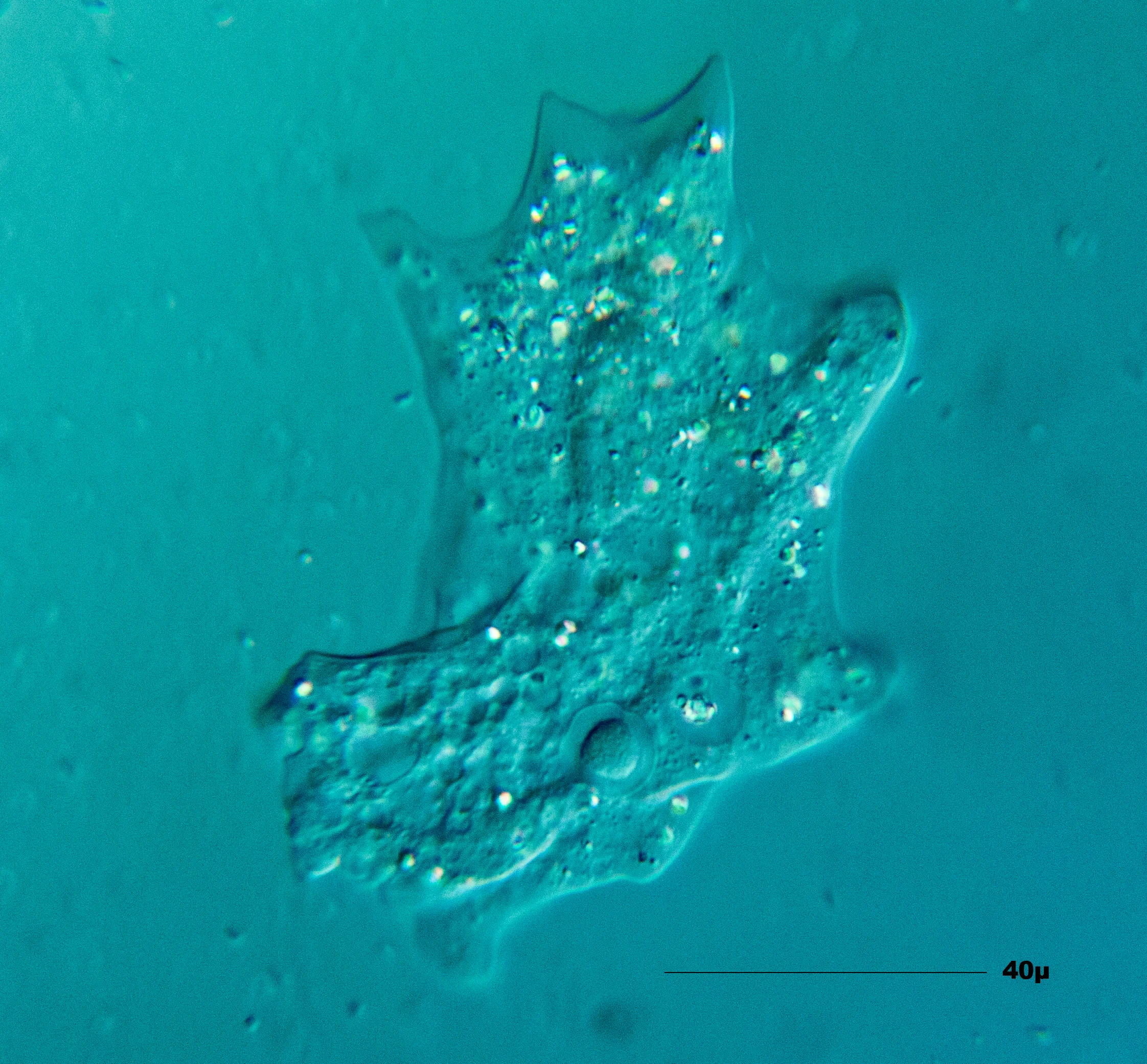 Amoeba_(Amöbe)_01.jpg