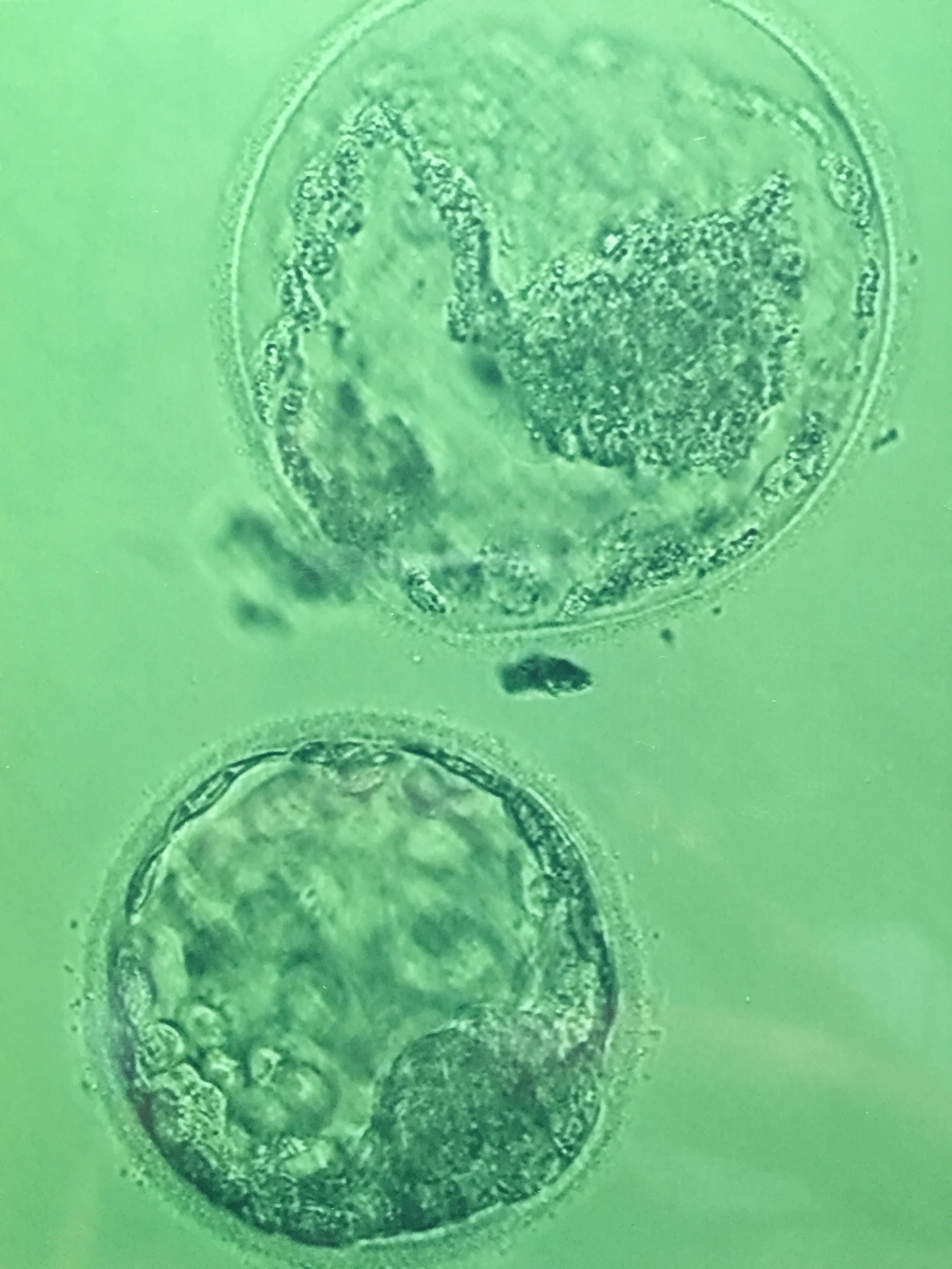 Frozen Embryo Transfer Update
