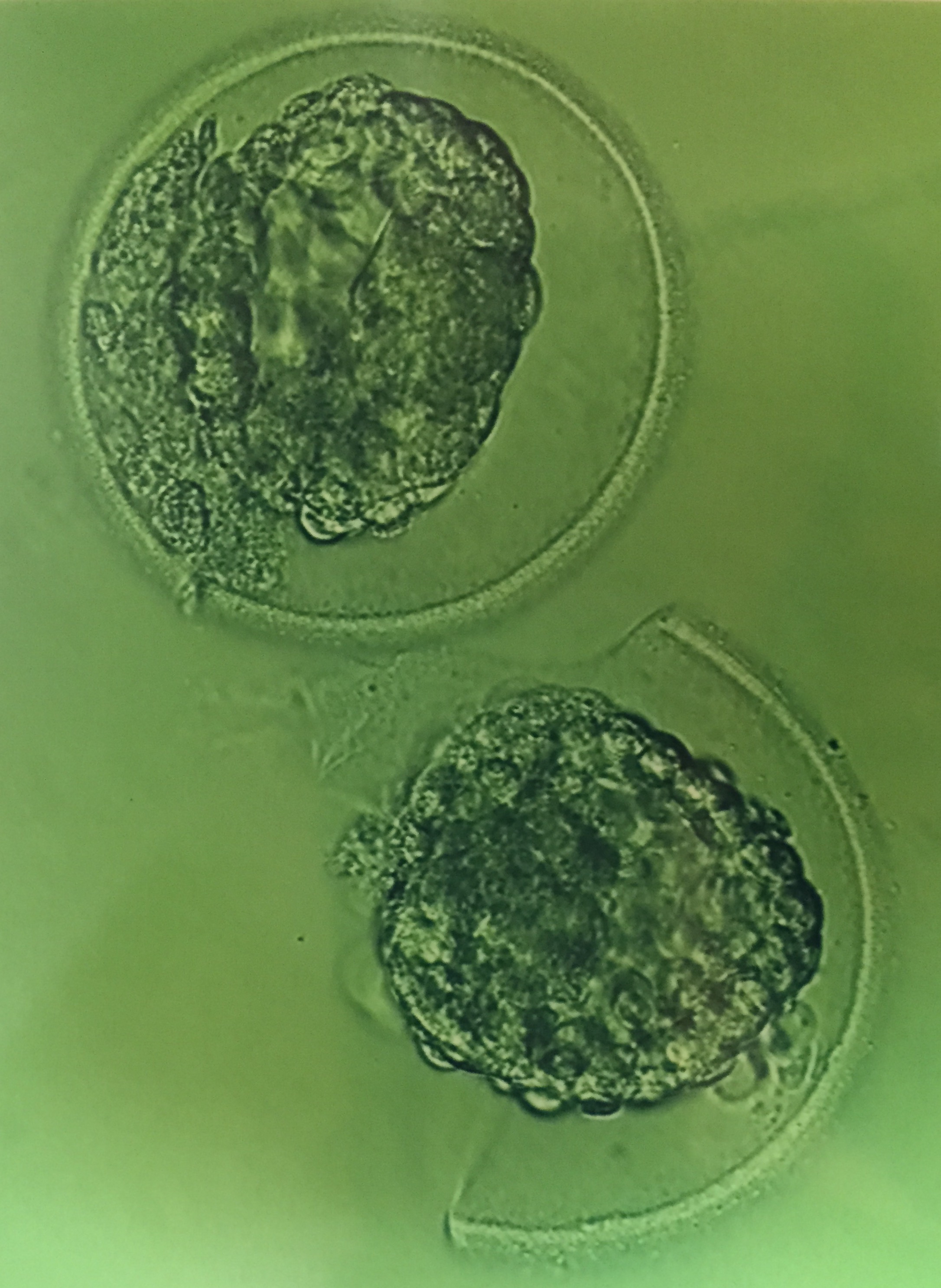 Embryos: August 3, 2015