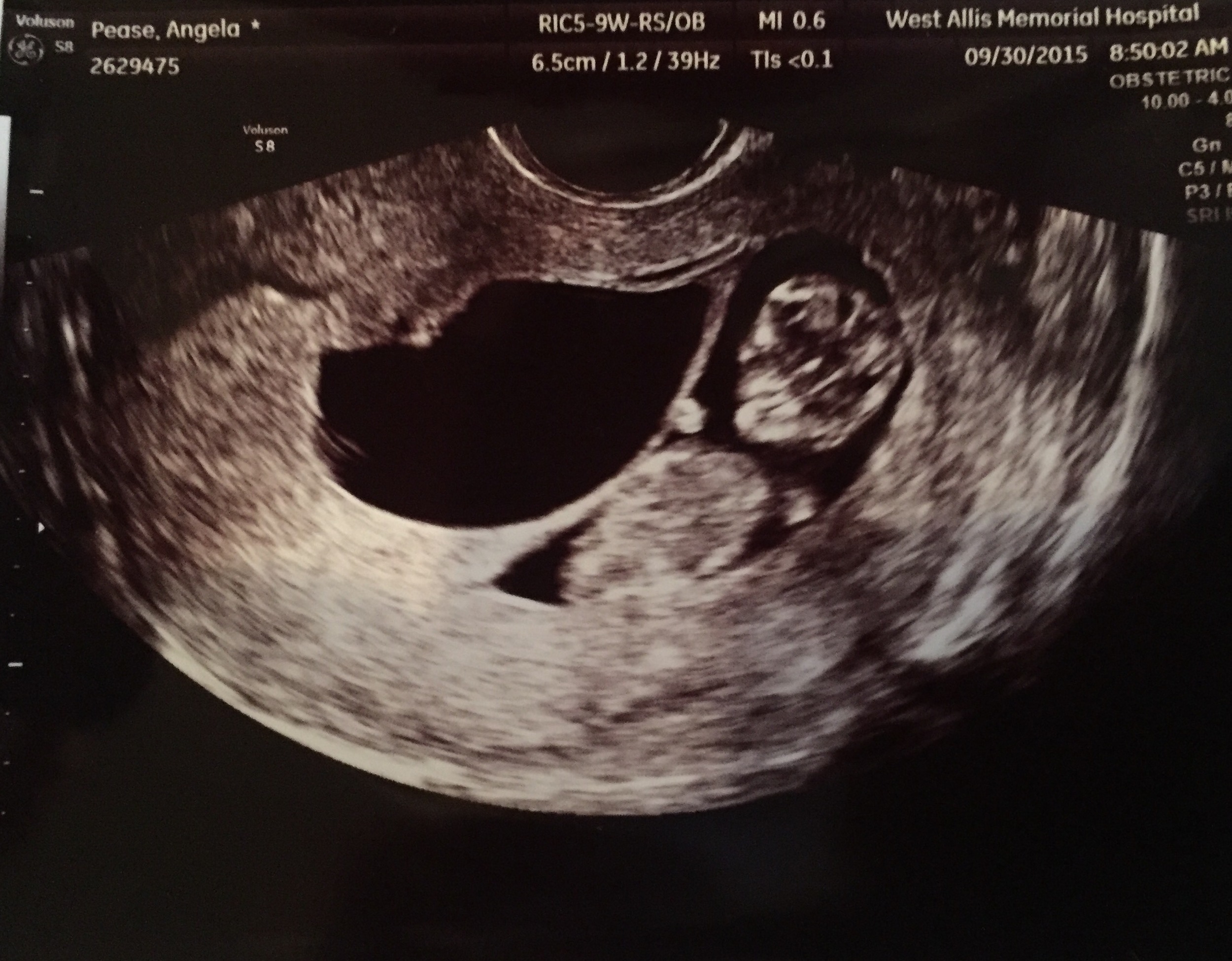 11 weeks: 9/30/15