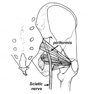 Pirformis muscle.jpg