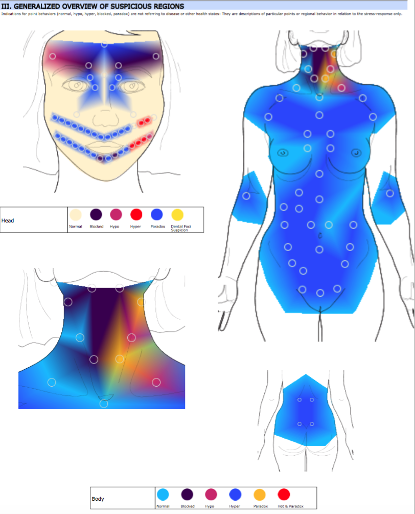 Initial Body Thermography Scan