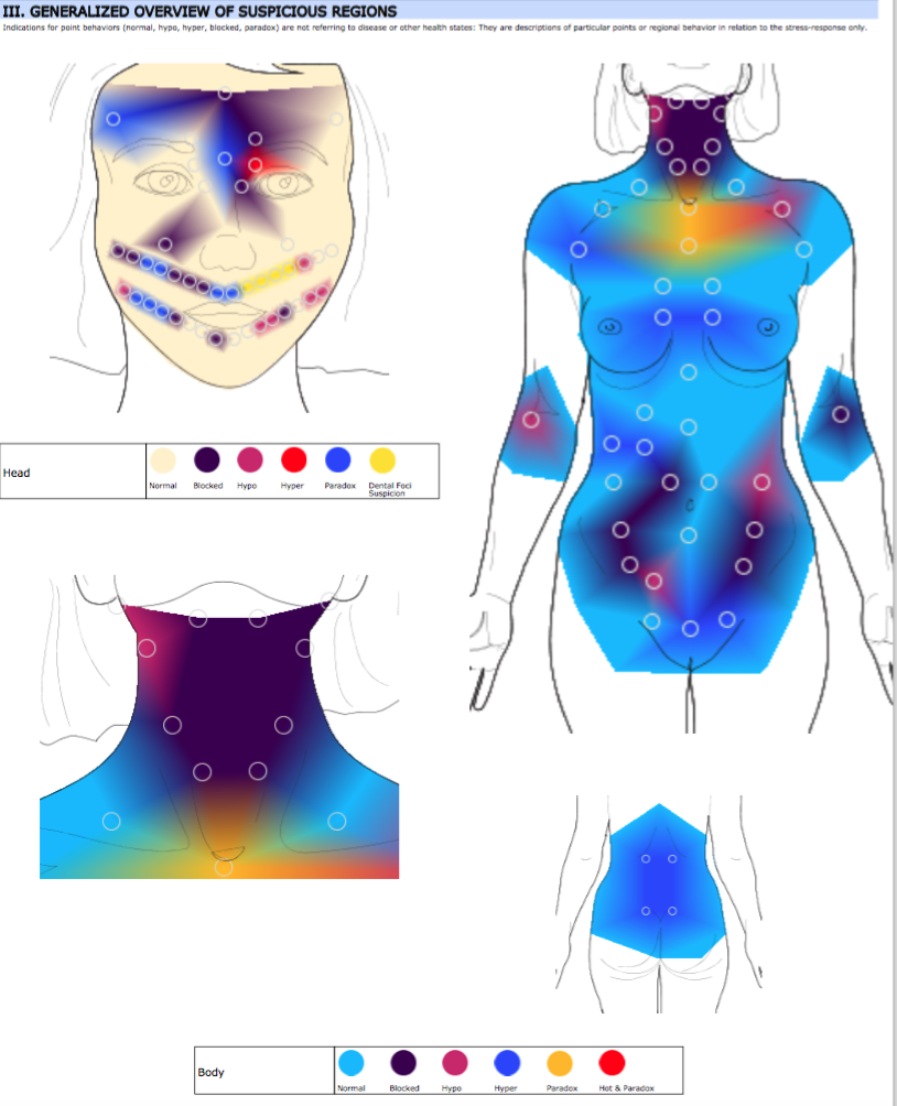 Initial Body Thermography Scan