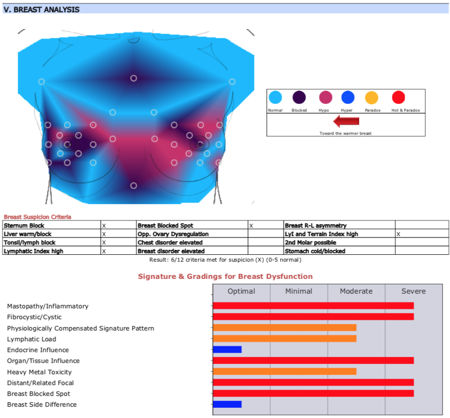 Initial Breast Scan