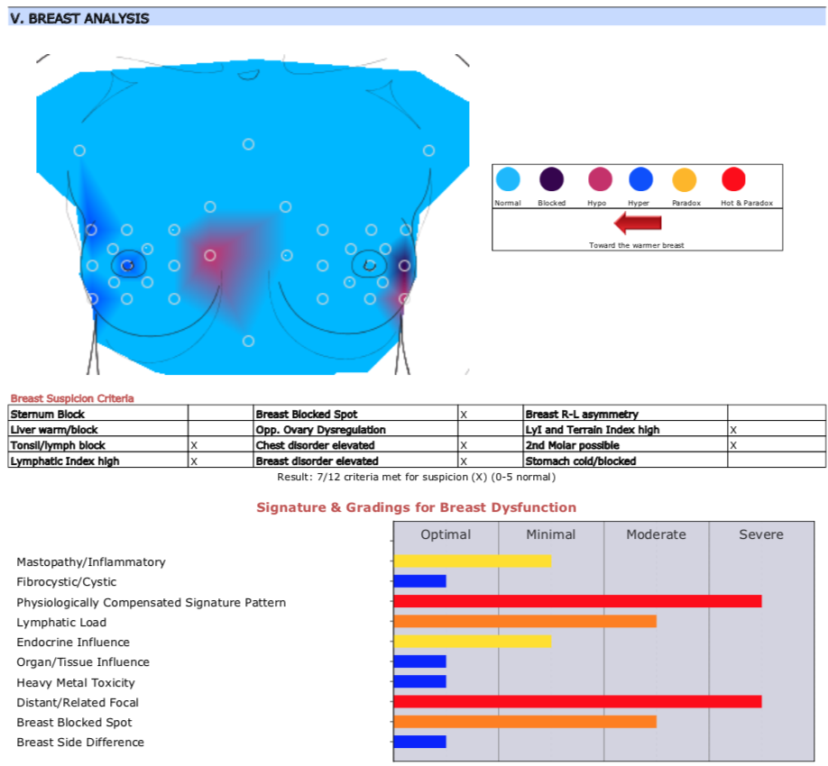Thermography Breast Scan 4 months later